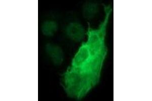 Image no. 2 for anti-Tyrosine Hydroxylase (TH) antibody (ABIN1501367) (Tyrosine Hydroxylase antibody)