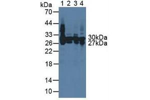 Western blot analysis of (1) Rat Serum, (2) Rat Liver Tissue, (3) Rat Heart Tissue and (4) Rat Spleen Tissue. (CA2 antibody)