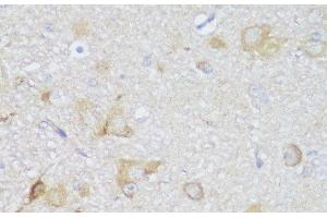 Immunohistochemistry of paraffin-embedded Rat brain using EDC3 Polyclonal Antibody at dilution of 1:150 (40x lens). (EDC3 antibody)