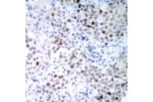 Image no. 1 for anti-Tumor Protein P53 (TP53) (pSer6) antibody (ABIN318095) (p53 antibody  (pSer6))