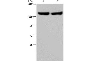 Western Blot analysis of Human placenta and fetal liver tissue using ITGA2B Polyclonal Antibody at dilution of 1:650 (Integrin Alpha2b antibody)