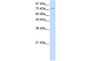 WB Suggested Anti-ZNF441 Antibody Titration:  1. (ZNF441 antibody  (N-Term))