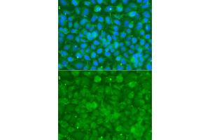 Immunofluorescence analysis of A549 cells using SERPINA3 antibody. (SERPINA3 antibody  (AA 24-423))