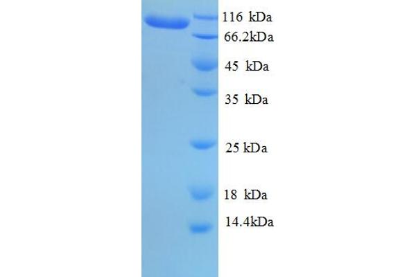 EEF2 Protein (AA 2-858) (His tag)