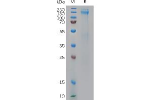 Human IGF-1R Protein, His Tag on SDS-PAGE under reducing condition. (IGF1R Protein (AA 31-932) (His tag))
