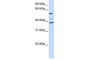 Western Blotting (WB) image for anti-Solute Carrier Family 25 (Mitochondrial Carrier, Graves Disease Autoantigen), Member 16 (SLC25A16) antibody (ABIN2458815) (SLC25A16 antibody)