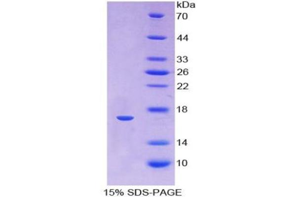 ANGPTL1 Protein