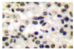 Image no. 2 for anti-c-Fos (c-Fos) antibody (ABIN265423) (c-FOS antibody)
