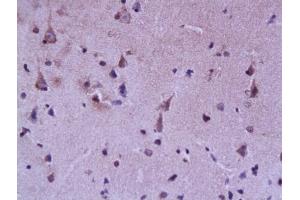 Formalin-fixed and paraffin embedded rat brain labeled with Rabbit Anti FABP7/BLBP/FABP(brain) Polyclonal Antibody, Unconjugated (ABIN739475) at 1:200 followed by conjugation to the secondary antibody and DAB staining (FABP7 antibody  (AA 6-23))