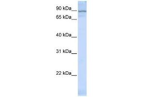 Western Blot showing ZNF598 antibody used at a concentration of 1-2 ug/ml to detect its target protein. (ZNF598 antibody  (Middle Region))