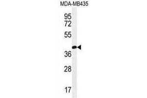 CLDN16 Antibody (N-term) western blot analysis in MDA-MB435 cell line lysates (35µg/lane). (Claudin 16 antibody  (N-Term))