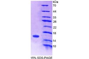 Image no. 1 for Secretin (SECR) (AA 26-133) protein (His tag) (ABIN6236718) (Secretin Protein (SECR) (AA 26-133) (His tag))