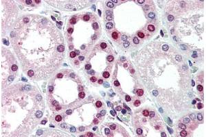 Human Kidney (formalin-fixed, paraffin-embedded) stained with ANP32A antibody ABIN461886 at 5 ug/ml followed by biotinylated goat anti-rabbit IgG secondary antibody ABIN481713, alkaline phosphatase-streptavidin and chromogen. (PHAP1 antibody  (C-Term))