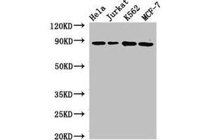 Western Blot Positive WB detected in: Hela whole cell lysate, Jurkat whole cell lysate, K562 whole cell lysate, MCF-7 whole cell lysate All lanes: CANX antibody at 2. (Calnexin antibody  (AA 265-469))