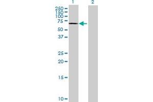 Lane 1: HDAC1 transfected lysate ( 53. (HDAC1 293T Cell Transient Overexpression Lysate(Denatured))