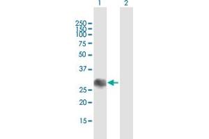 Western Blot analysis of SOCS1 expression in transfected 293T cell line by SOCS1 MaxPab polyclonal antibody. (SOCS1 antibody  (AA 1-211))