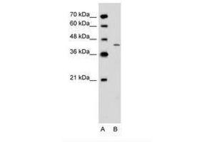 Image no. 1 for anti-Dihydroorotate Dehydrogenase (DHODH) (AA 301-350) antibody (ABIN6736626) (DHODH antibody  (AA 301-350))