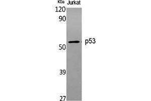 Western Blot analysis of various cells using p53 Polyclonal Antibody diluted at 1:1000. (p53 antibody)