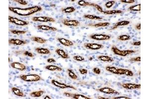 IHC testing of FFPE mouse kidney with SLC12A1 antibody. (SLC12A1 antibody)