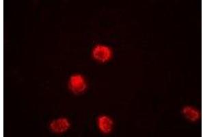 Immunofluorescent analysis of KDM1A staining in Jurkat cells. (LSD1 antibody)