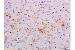 Formalin-fixed and paraffin embedded rat brain labeled with Anti-NFkB Inducing Kinase NIK Polyclonal Antibody, Unconjugated (ABIN724520) at 1:200 followed by conjugation to the secondary antibody and DAB staining (MAP3K14 antibody  (AA 901-947))