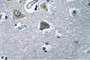 Image no. 2 for anti-Carbonic Anhydrase VB, Mitochondrial (CA5B) antibody (ABIN317824) (CA5B antibody)
