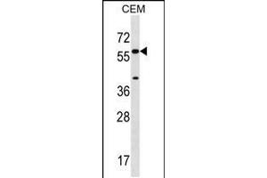 Western blot analysis in CEM cell line lysates (35ug/lane). (CYP21A2 antibody  (AA 160-188))