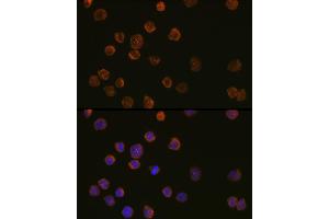 Immunofluorescence analysis of THP-1 cells using ITGAX Rabbit pAb (ABIN6131274, ABIN6142576, ABIN6142577 and ABIN6218579) at dilution of 1:100 (40x lens). (CD11c antibody  (AA 100-350))