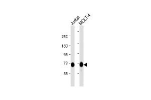 All lanes : Anti-Z Antibody  at 1:1000 dilution Lane 1: Jurkat whole cell lysate Lane 2: MOLT-4 whole cell lysate Lysates/proteins at 20 μg per lane. (ZAP70 antibody  (AA 252-282))