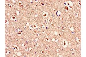 Immunohistochemistry of paraffin-embedded human brain tissue using ABIN7159976 at dilution of 1:100 (ERK2 antibody  (AA 133-316))