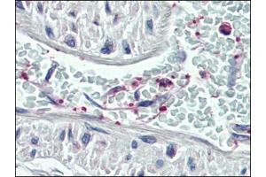 Human Vessel, Platelets (formalin-fixed, paraffin-embedded) stained with PLEKat 3. (Pleckstrin antibody  (C-Term))