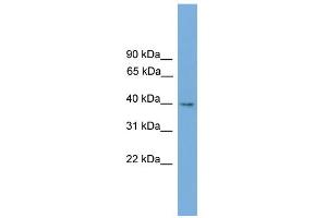 WB Suggested Anti-Tmem130 Antibody Titration:  0. (TMEM130 antibody  (Middle Region))