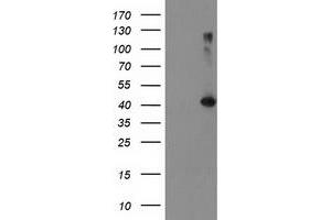 Western Blotting (WB) image for anti-TBC1 Domain Family, Member 21 (TBC1D21) antibody (ABIN1501314) (TBC1D21 antibody)