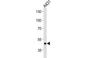 Western Blotting (WB) image for anti-Fibrinogen gamma Chain (FGG) antibody (ABIN3003142) (FGG antibody)