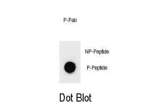 Dot blot analysis of Phospho-RP1-S41 Antibody Phospho-specific b (ABIN1539704 and ABIN2839899) on nitrocellulose membrane. (PARP1 antibody  (pSer41))