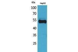 Western Blotting (WB) image for anti-Ubiquitin (Ubiquitin) antibody (ABIN3181036) (Ubiquitin antibody)