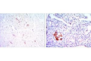 Immunohistochemical analysis of paraffin-embedded brain tissues (left) and pancreas tissues (right) using KLHL13 mouse mAb with DAB staining. (KLHL13 antibody)