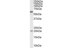 Image no. 1 for anti-Bone Morphogenetic Protein Receptor 1A (BMPR1A) (Internal Region) antibody (ABIN374667) (BMPR1A antibody  (Internal Region))