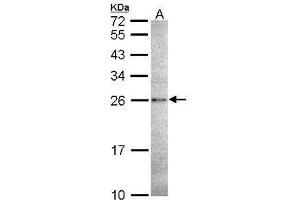 WB Image Sample (30 ug of whole cell lysate) A: A431 , 12% SDS PAGE antibody diluted at 1:1000 (CASP14 antibody  (C-Term))
