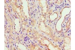 Immunohistochemistry of paraffin-embedded human kidney tissue using ABIN7143650 at dilution of 1:100 (ADH4 antibody  (AA 1-380))