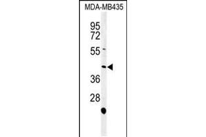 Western blot analysis of NOXA1 Antibody in MDA-MB435 cell line lysates (35ug/lane) (NOXA1 antibody  (C-Term))