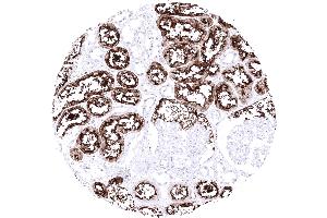 Kidney cortex A strong ACE2 immunostaining occurs in proximal tubuli of the kidney (Recombinant ACE2 antibody  (AA 705-805))