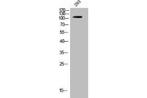 Western Blot analysis of 293 cells using Phospho-Raf-B (S446) Polyclonal Antibody (BRAF antibody  (pSer446))