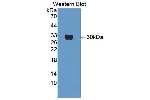 Western blot analysis of the recombinant protein. (OS9 antibody  (AA 465-666))