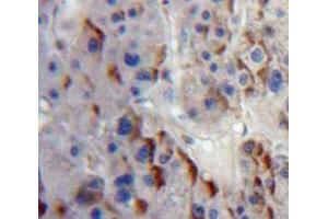 Immunohistochemistry (IHC) image for anti-ADAM Metallopeptidase Domain 8 (ADAM8) (AA 145-493) antibody (ABIN1866534)