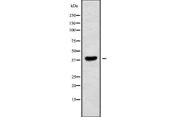 MAGEA10 antibody  (Internal Region)