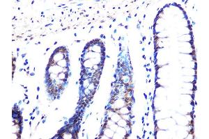 Immunohistochemistry of paraffin-embedded human colon using MB/MB/ML2 Rabbit mAb (ABIN1679325, ABIN3019109, ABIN3019110 and ABIN7101716) at dilution of 1:100 (40x lens). (MAD2L2 antibody)