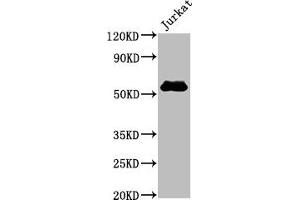 Western Blot Positive WB detected in Jurkat whole cell lysate All lanes CD4 antibody at 0. (Recombinant CD4 antibody)
