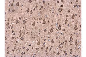 IHC-P Image BACE1 antibody [N1C2] detects BACE1 protein at cytoplasm in Rat brain by immunohistochemical analysis. (BACE1 antibody)