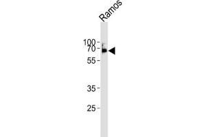 Western Blotting (WB) image for anti-Lymphocyte-Specific Protein tyrosine Kinase (LCK) antibody (ABIN3001655) (LCK antibody)